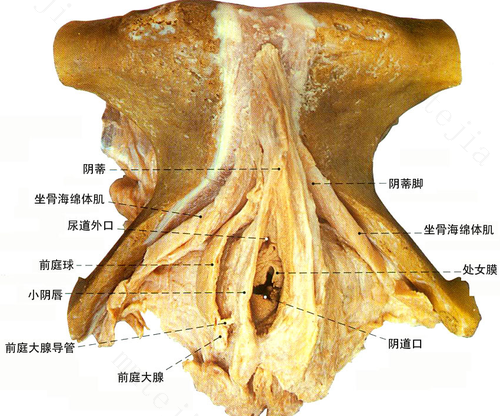 前庭大腺囊肿是不是性生活造成的