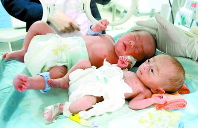 怀孕双胞胎的备孕方法