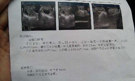 胎盘植入b超检查能发现吗孕妇