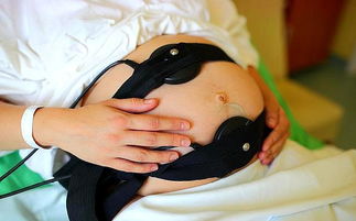 宝宝在肚子里缺氧母体有什么症状