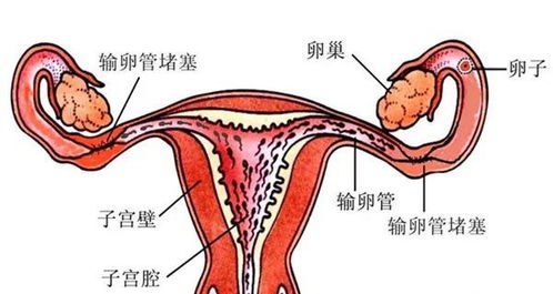 黄体功能不全会导致月经量多吗