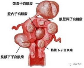 黄体功能不全会导致月经量多吗