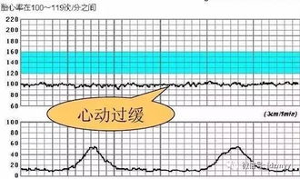 胎心监护的作用是什么呢