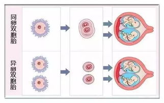怎样看同卵双胞还是异卵双胞