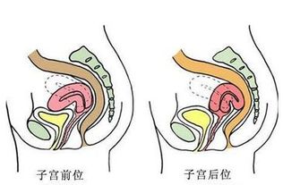 孕晚期胎盘前壁可以顺产吗