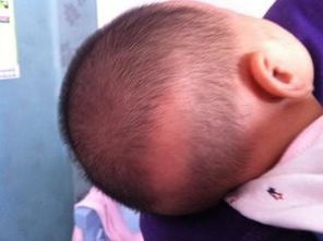 两岁宝宝头发稀少怎么办
