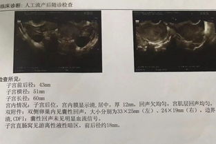 女性做输卵管通水痛吗