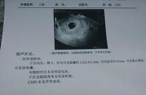 38周胎儿发育标准偏小为什么不能顺产