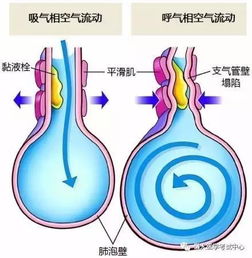 哮喘支气管炎是怎么形成的？