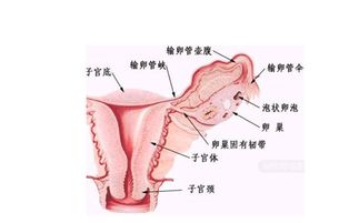 输卵管不通介入治疗有用吗?