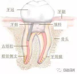 根管治疗的整过过程需时