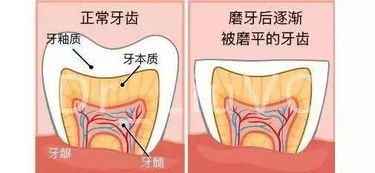 孕期常见的4种牙齿疾病图片