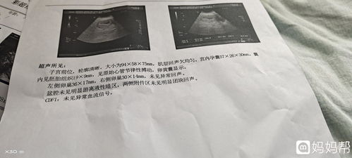 怀孕9周做b超可以看到胎儿吗