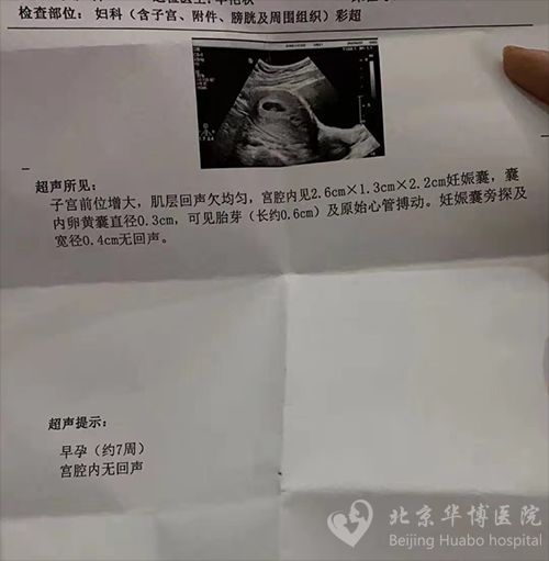 输卵管造影有无痛的吗?