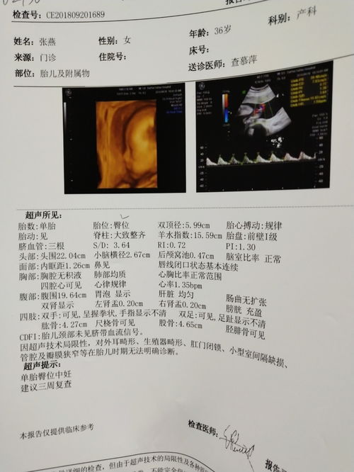 四维超声诊断报告单