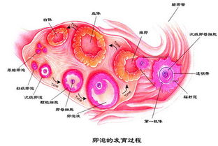 双侧多囊卵巢和多囊卵巢综合症一样吗