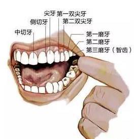 拔智齿前需要消炎吗