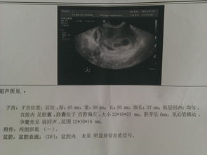 怀孕六周妊娠囊15x17mm正常吗