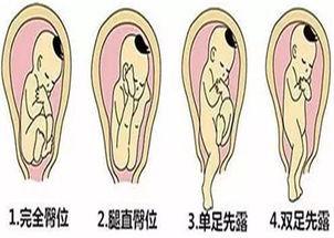 胎儿几个月定位