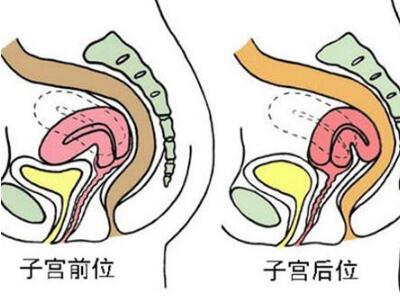 女人怎么判断自己是不是宫寒