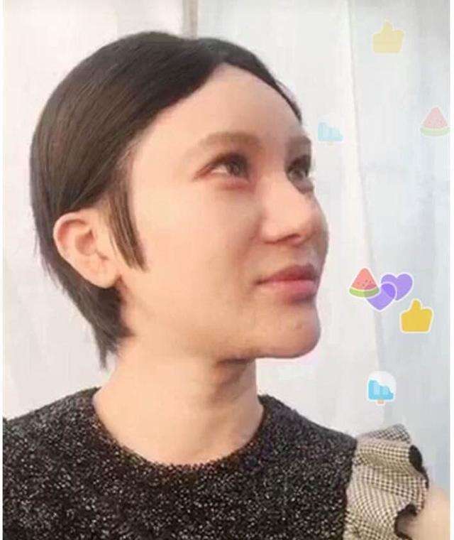 面部整容后有什么后遗症