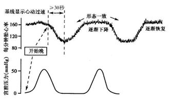 胎心音和胎动的区别