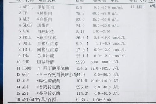 孕妇血常规检必须了解的四个指标是什么