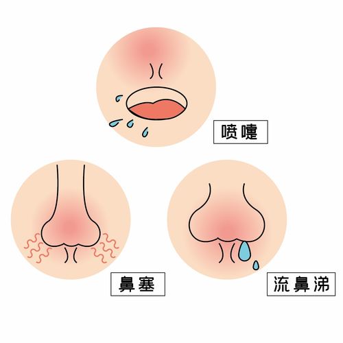 如何快速让感冒不流鼻涕流