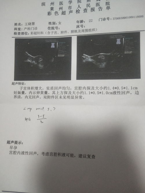 怀孕40天，看孕囊形状判宝宝性别准不准？