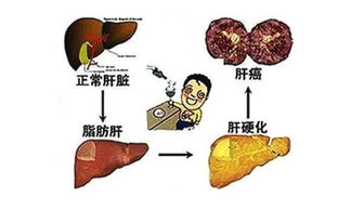 孕晚期孕妇不适症状