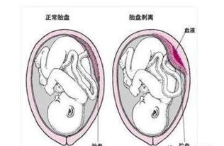 怀孕7周注意事项有哪些