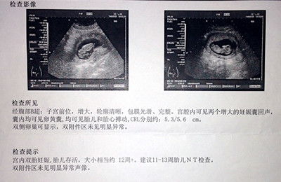 一般怀孕多少天b超才看到孕囊？我怀孕55天都看不到孕囊。是不是宫外孕...