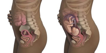 孕期前置胎盘有什么症状吗