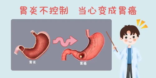 备孕胃难受怎么办