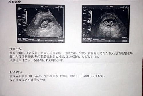 我到底怀孕了多久