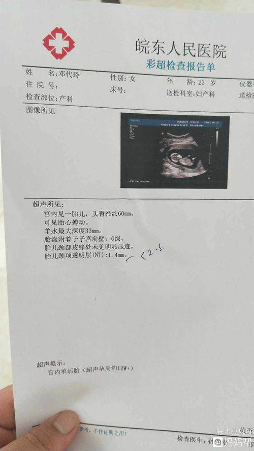 试管移植12周nt检查2.23正常吗?