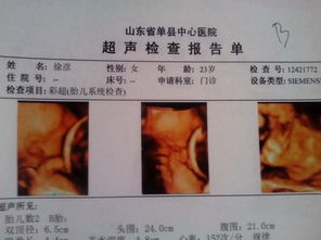 怀孕25周还能做四维吗视频