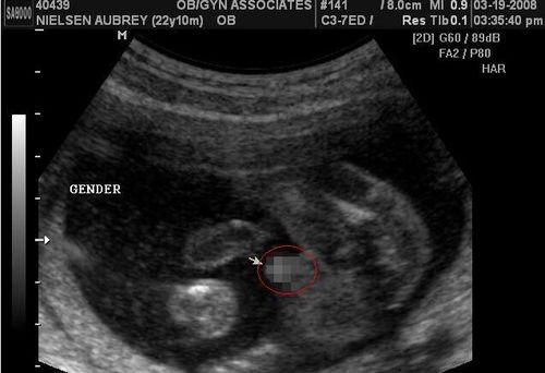 怀孕B超显示胎囊大小为28mm*25mm,囊内胚芽大小为6mm*10mm请问怀孕多少天了？