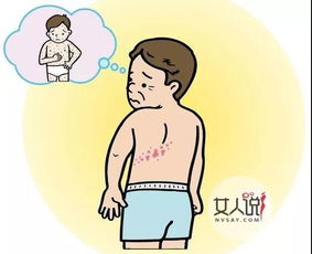 孕妇得了疱疹怎么办治