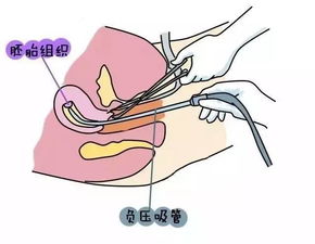 怀孕八周 胎儿 样子