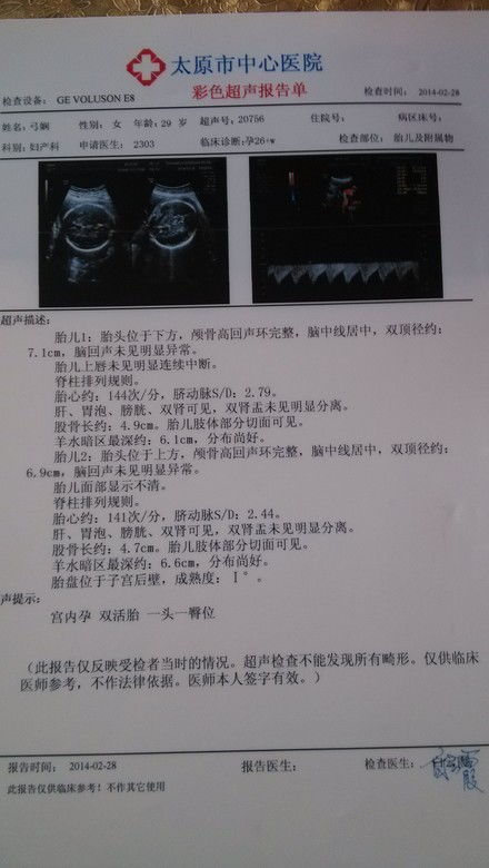 怀孕13周,胎心170/分正常吗