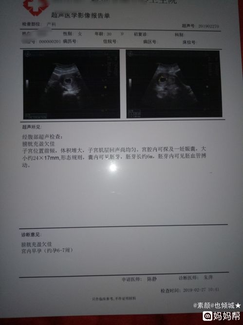 孕囊28×18mm是算隋型还是圆型的吗？