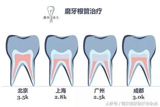 种植一颗牙要多少钱?