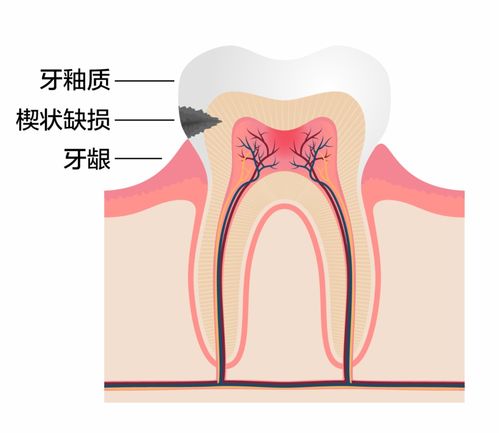 哪些不良生活方式会影响骨骼健康