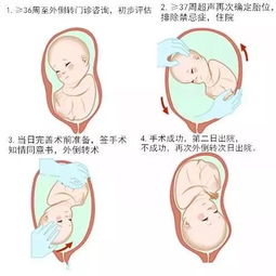 怀孕35周胎位还会不正吗