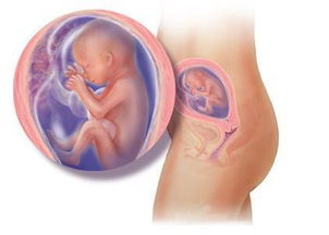 怀孕38周做胎心监护,宝宝心跳快,180次/分,请问宝宝是不是缺氧啊?应该怎么办?