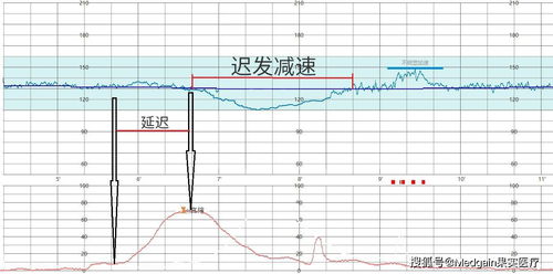 宝宝动的时候胎心率快达到180正常吗