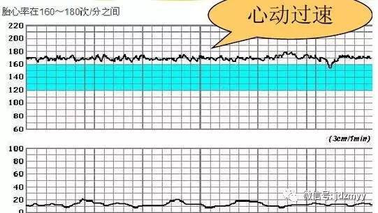 宝宝动的时候胎心率快达到180正常吗