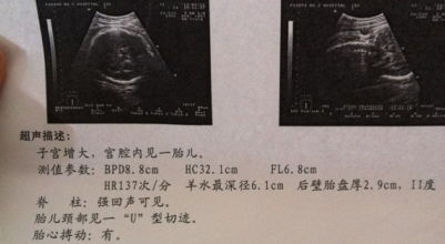 胎儿心率一分钟161属于正常吗