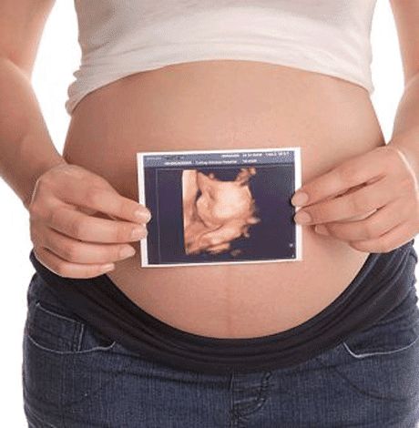 孕妇在医院照B超或三维彩超可以看出胎儿心脏发育异常问题吗?